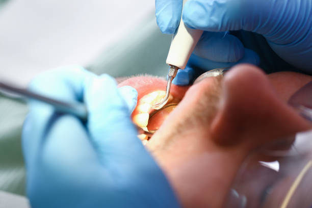 Best Urgent Care for Lost Fillings or Crowns in Sprague, WV