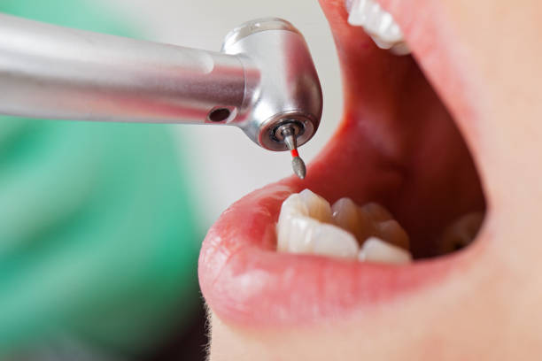 Best After-Hours Dental Trauma Care in Sprague, WV